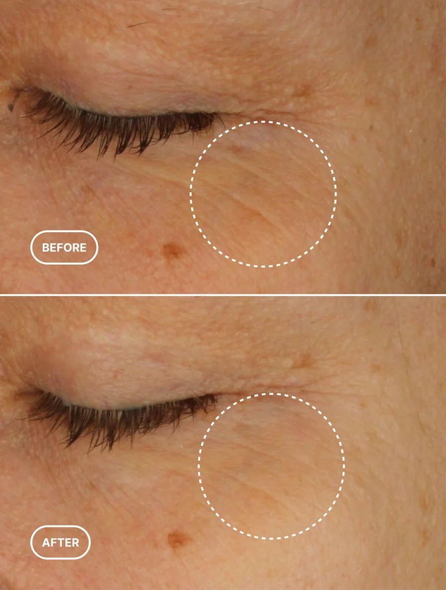 Retinol Alternative Eye Serum, 15ml